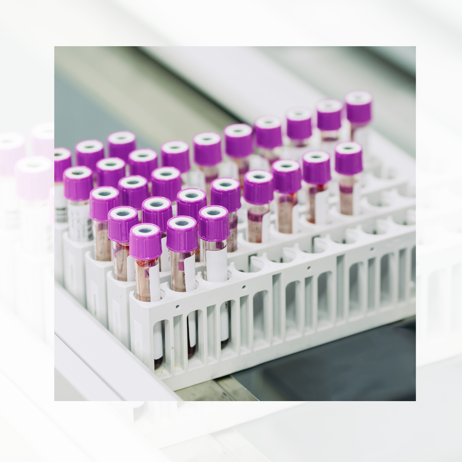 Test tubes for PSC research