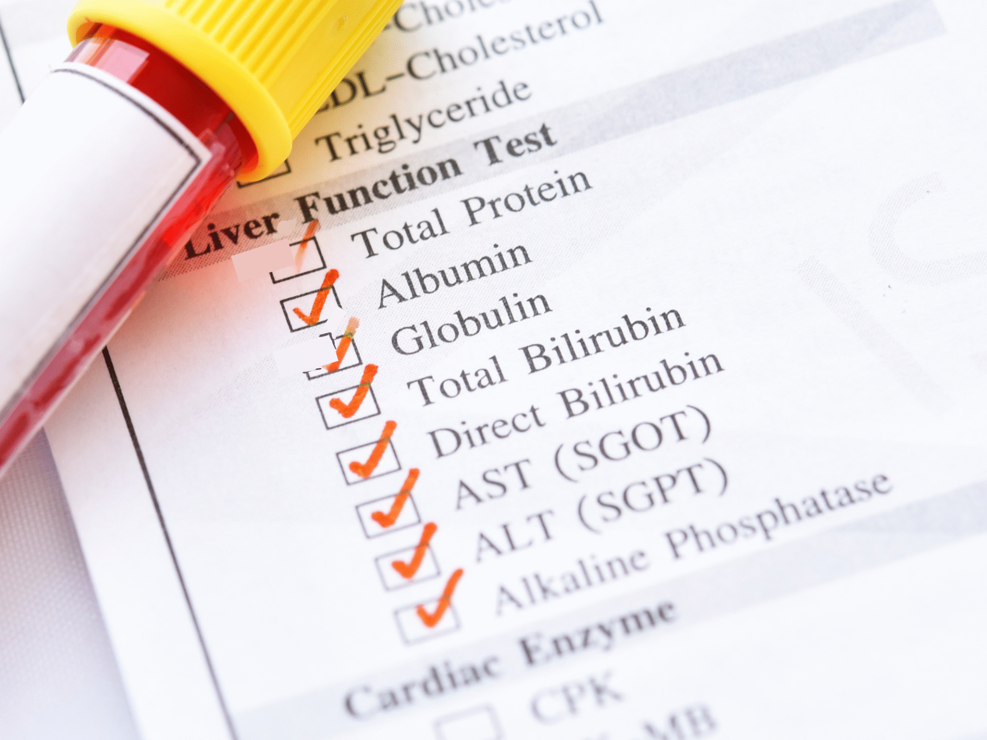 Liver blood test for PSC